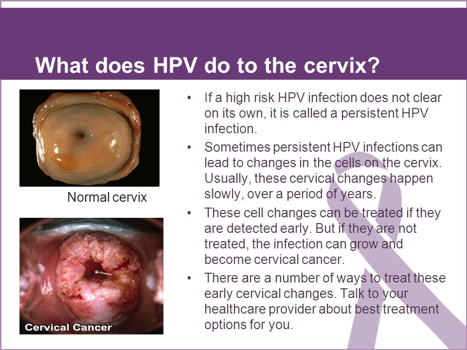 hpv high risk but normal pap