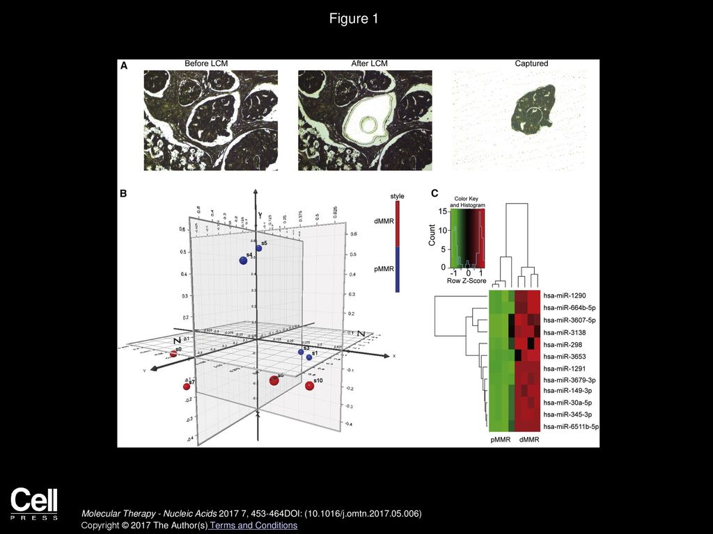 Figure 1 Microdissection and miRNA Microarray Analysis of dMMR and pMMR Colon Cancer Cells.