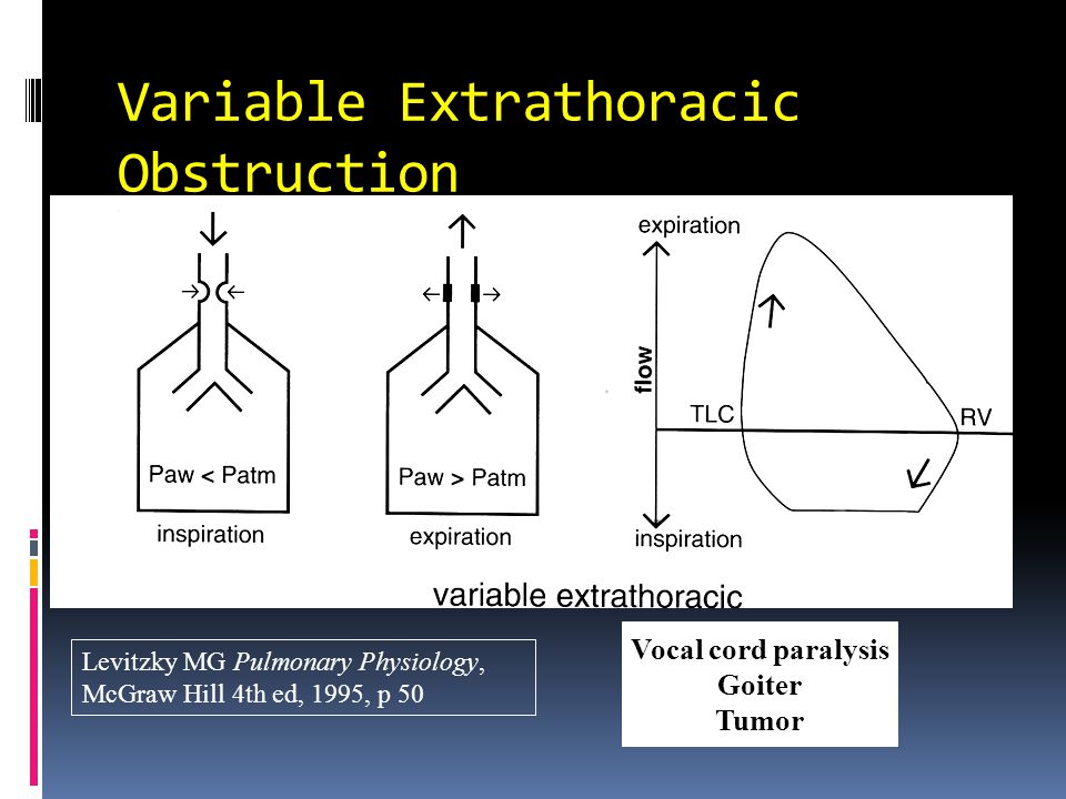 Variable Extrathoracic Obstruction