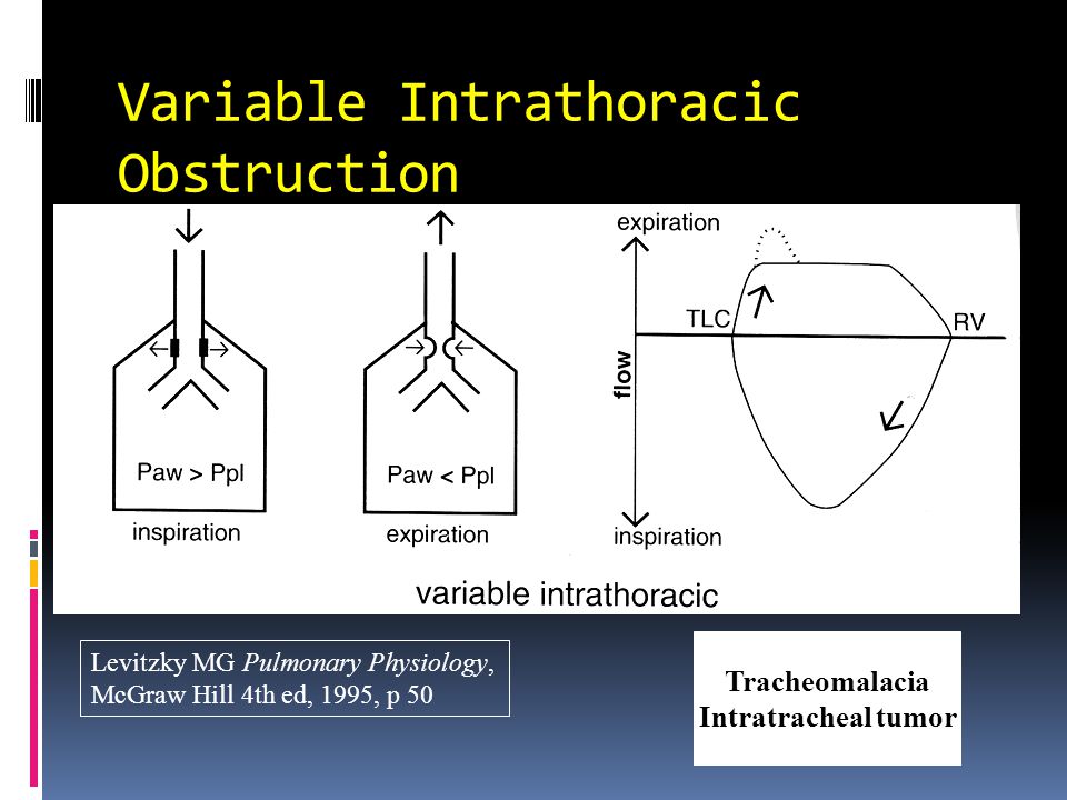 Variable Intrathoracic Obstruction