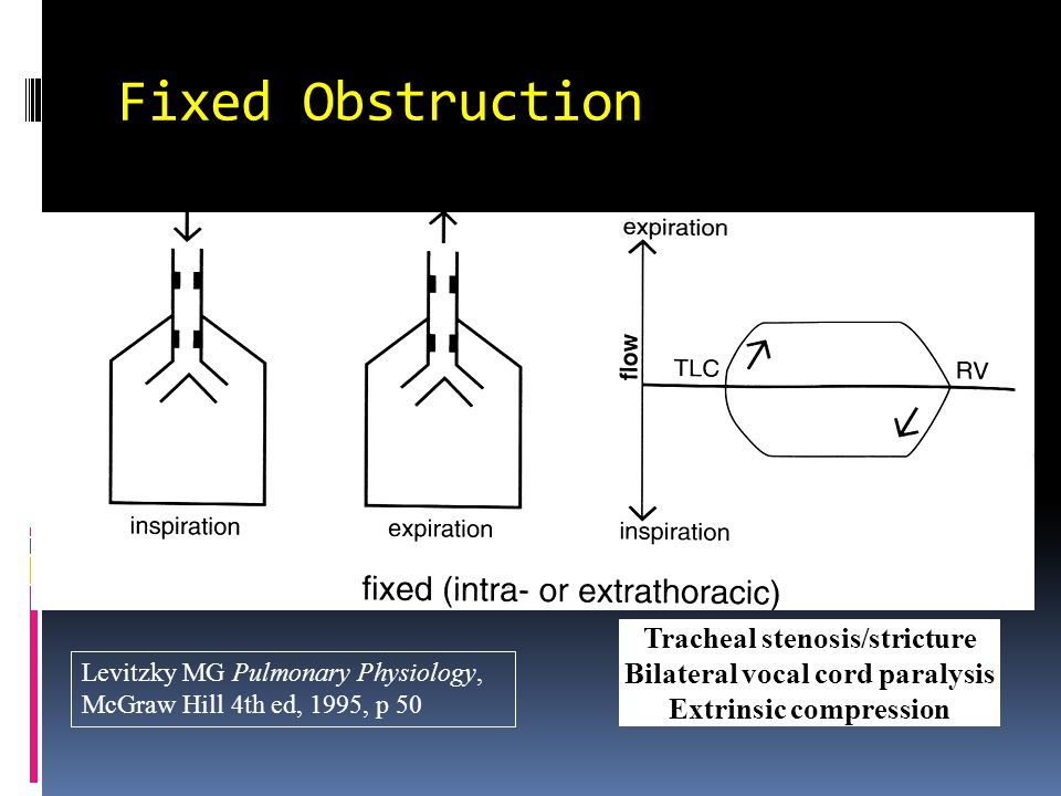 Fixed Obstruction Tracheal stenosis/stricture