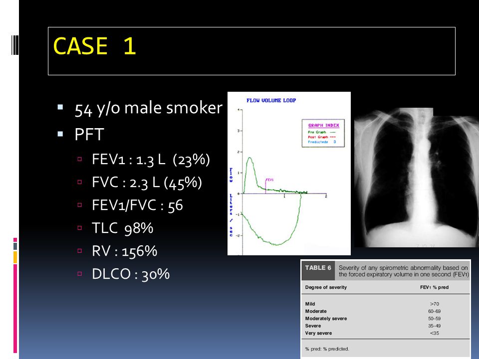 CASE 1 54 y/o male smoker PFT FEV1 : 1.3 L (23%) FVC : 2.3 L (45%)