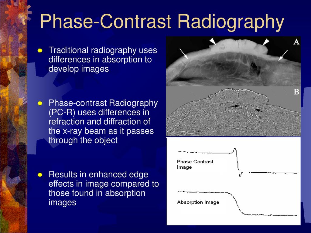 Optimization of Phase Contrast Imaging - ppt download