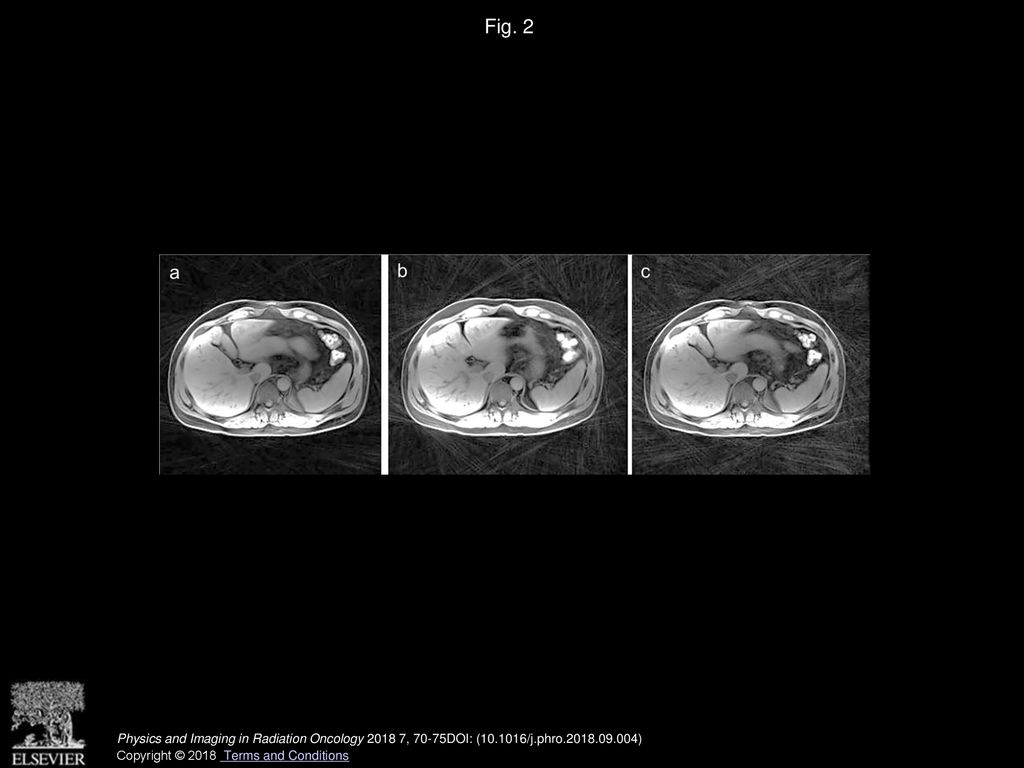 Physics and imaging in radiation oncology ppt download