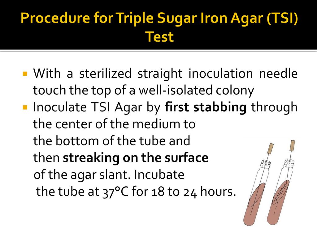 Procedure for Triple Sugar Iron Agar (TSI) Test
