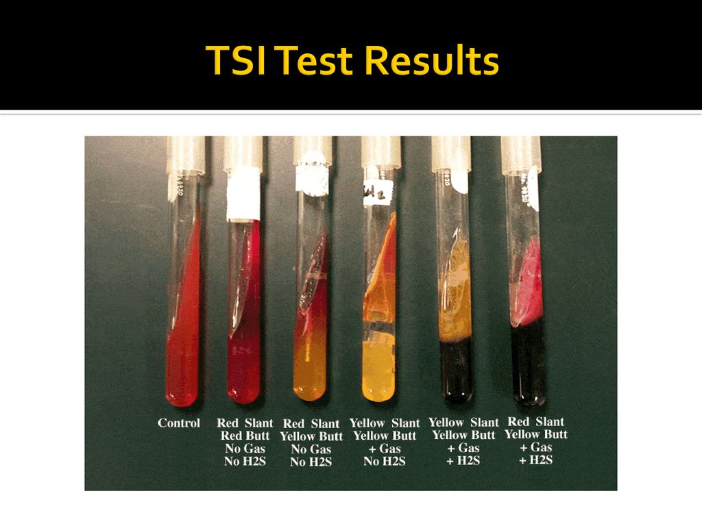 TSI Test Results