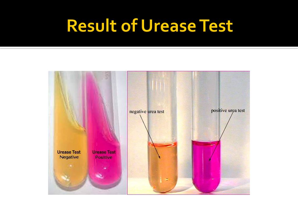 Result of Urease Test