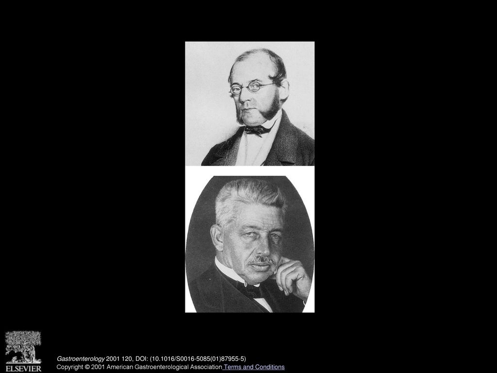 Rokitansky & Aschoff of the Rokitansky–Aschoff sinuses - ppt download