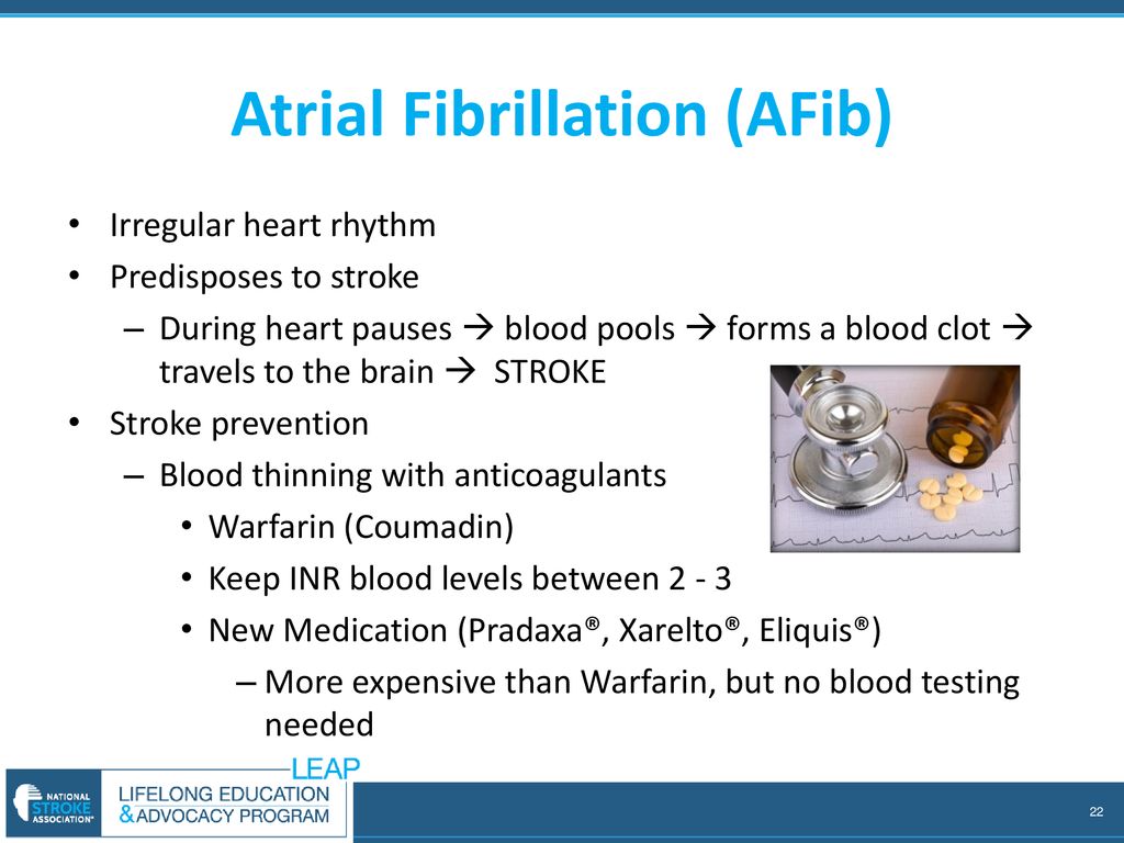 Stroke ppt download