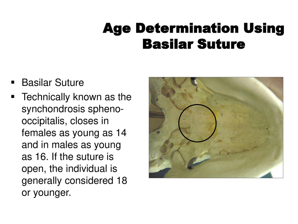 Age Determination Using Basilar Suture