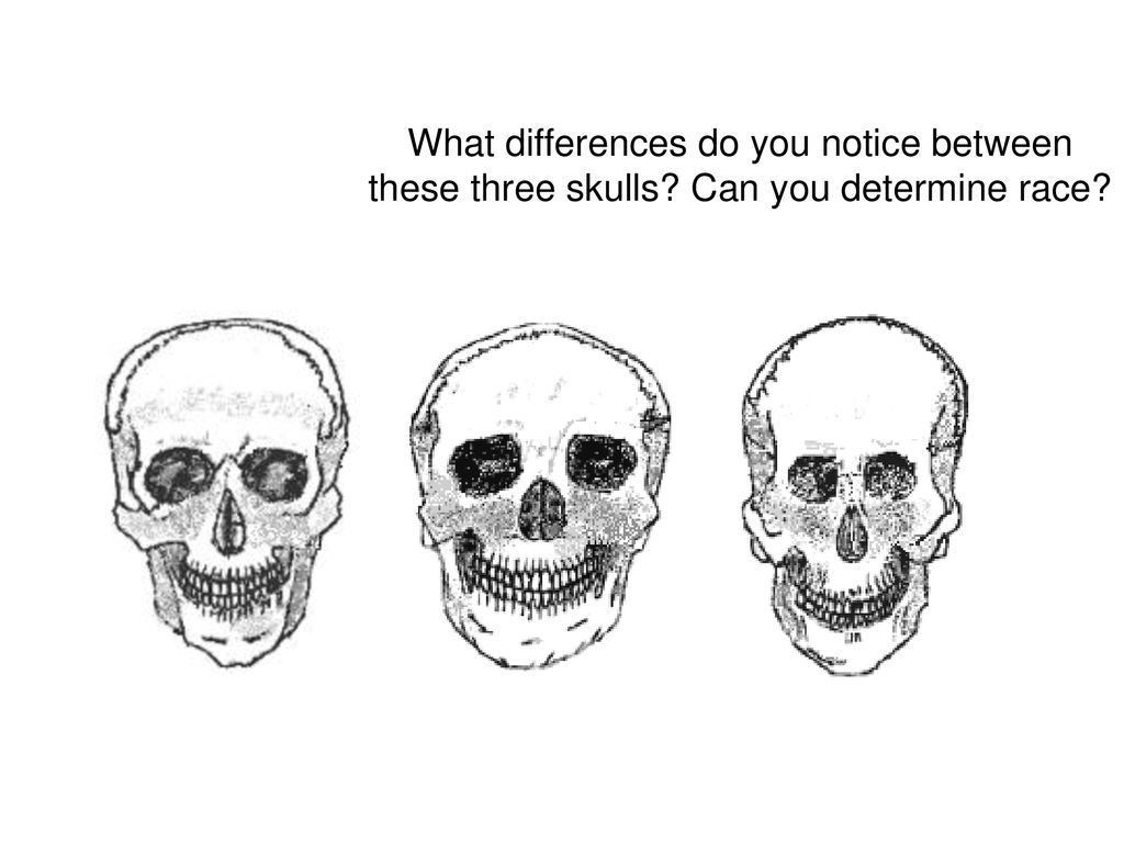 What differences do you notice between these three skulls