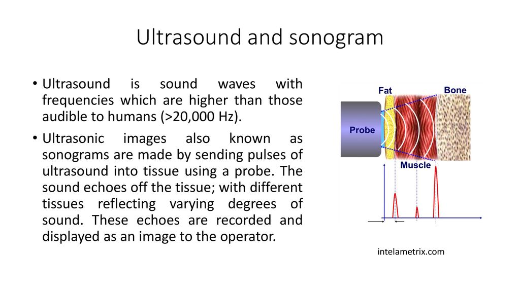 Ultrasonography. - ppt download