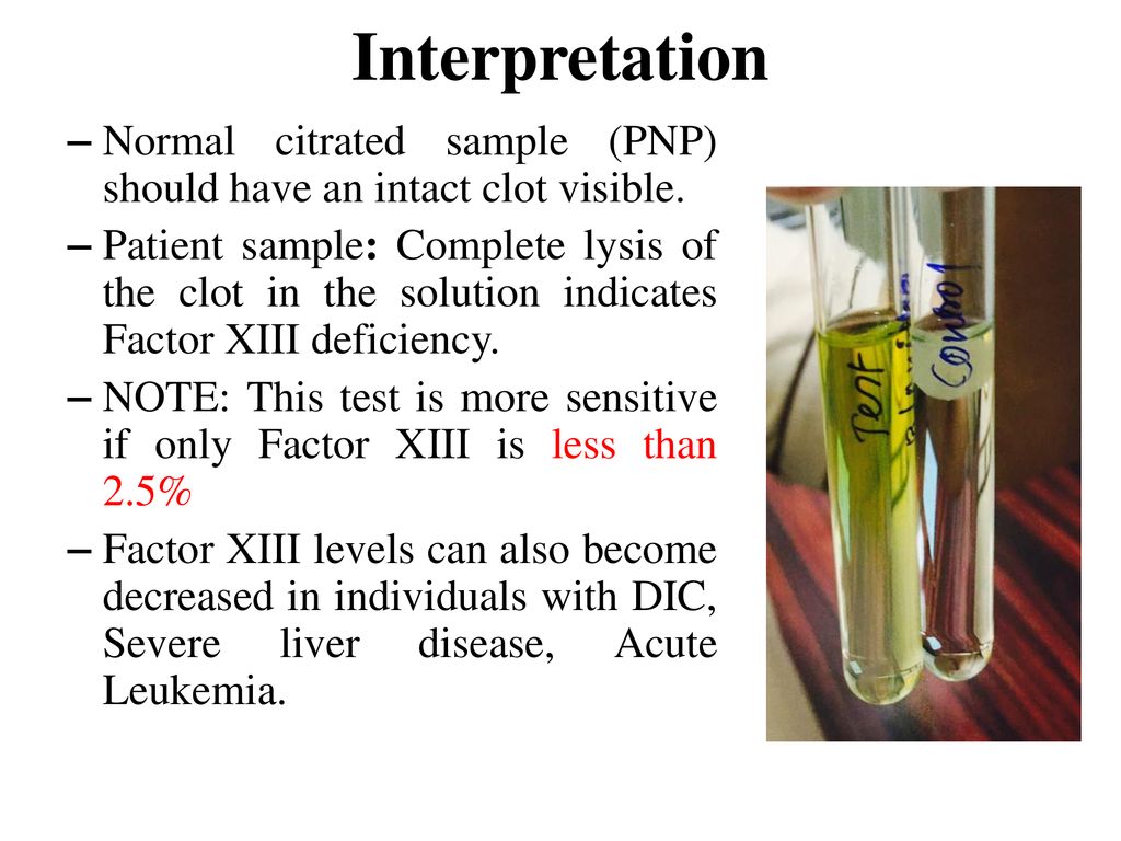 Interpretation Normal citrated sample (PNP) should have an intact clot visible.