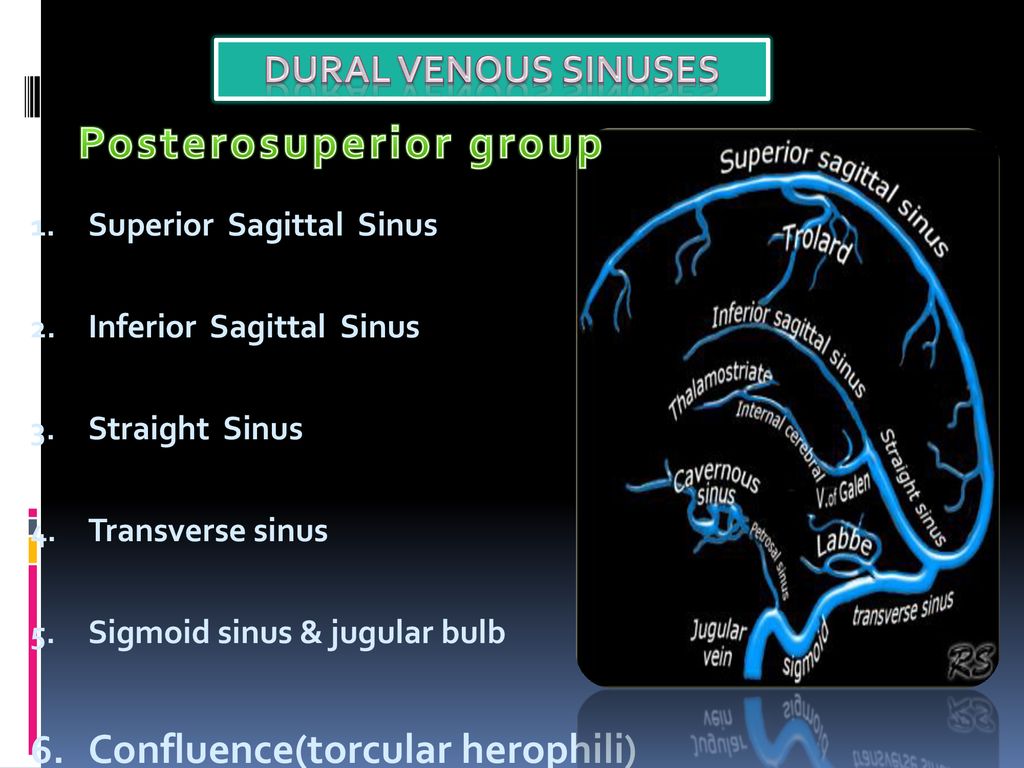 Cerebral Venous Anatomy And Ppt Download Cerebral Venous Anatomy And Ppt Download