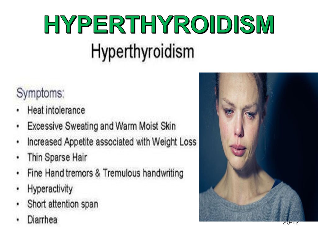 Endocrine Systems Use Of Thyroid Hormone To Control Overall Metabolism endocrine-systems-use-of-thyroid-hormone-to-control-overall-metabolism