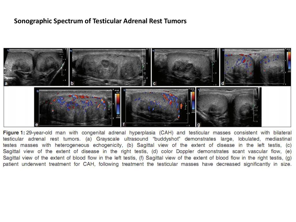 Ultrasound News Ppt Download