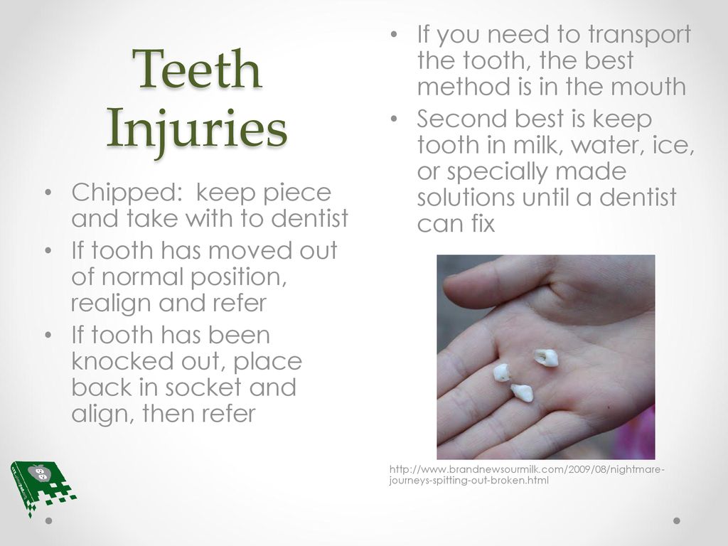 Teeth Injuries If you need to transport the tooth, the best method is in the mouth.