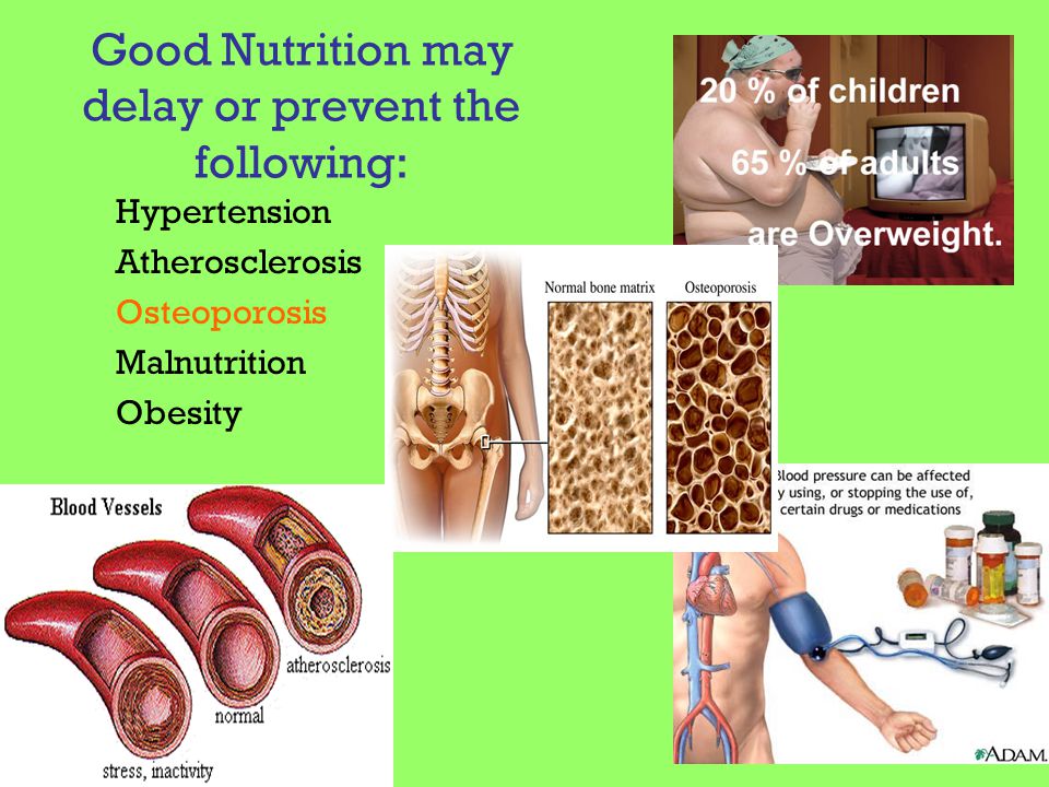 Good Nutrition may delay or prevent the following: