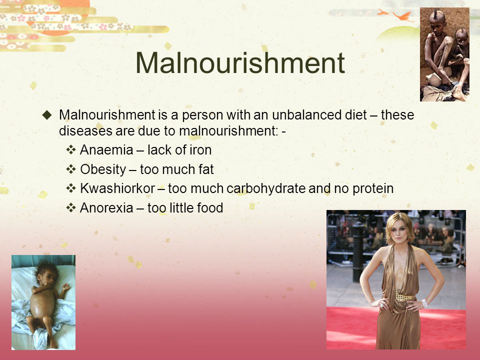 Malnourishment Malnourishment is a person with an unbalanced diet – these diseases are due to malnourishment: -