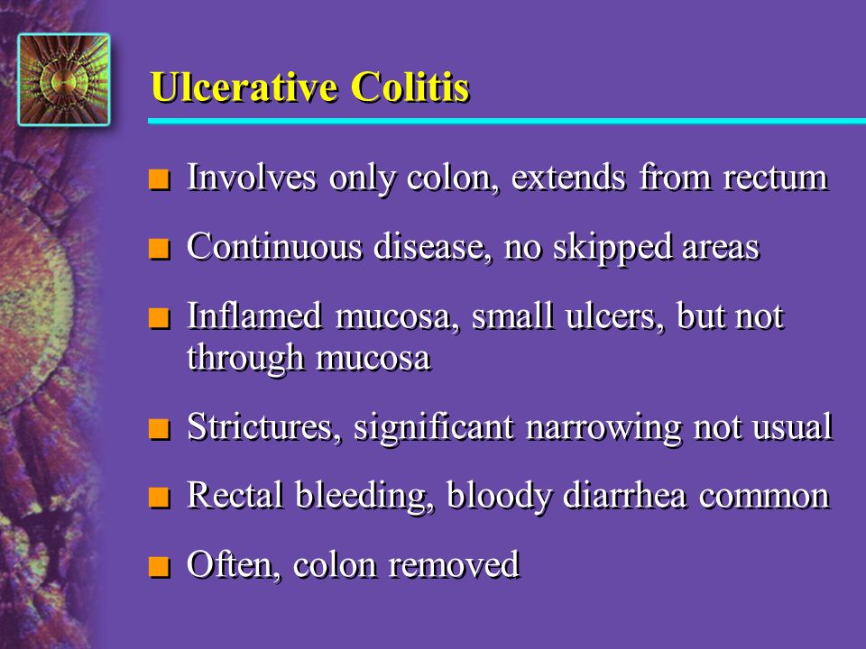 Ulcerative Colitis Involves only colon, extends from rectum