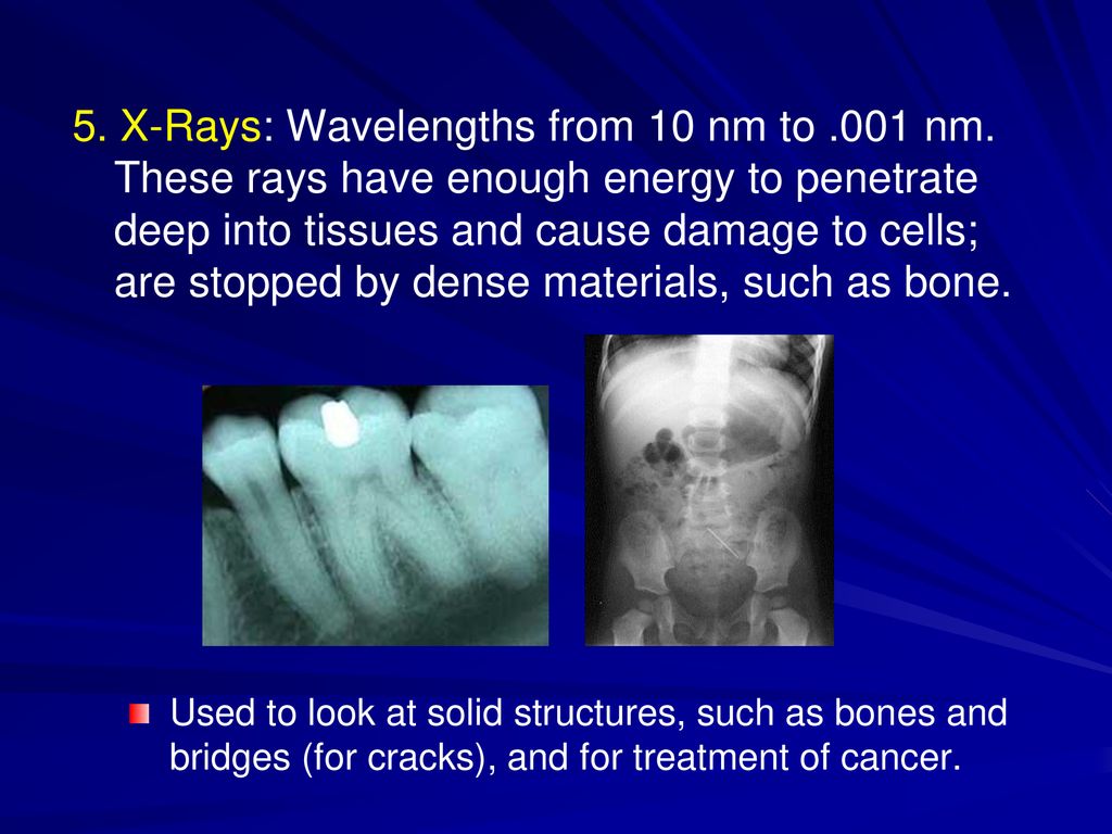 5. X-Rays: Wavelengths from 10 nm to. 001 nm