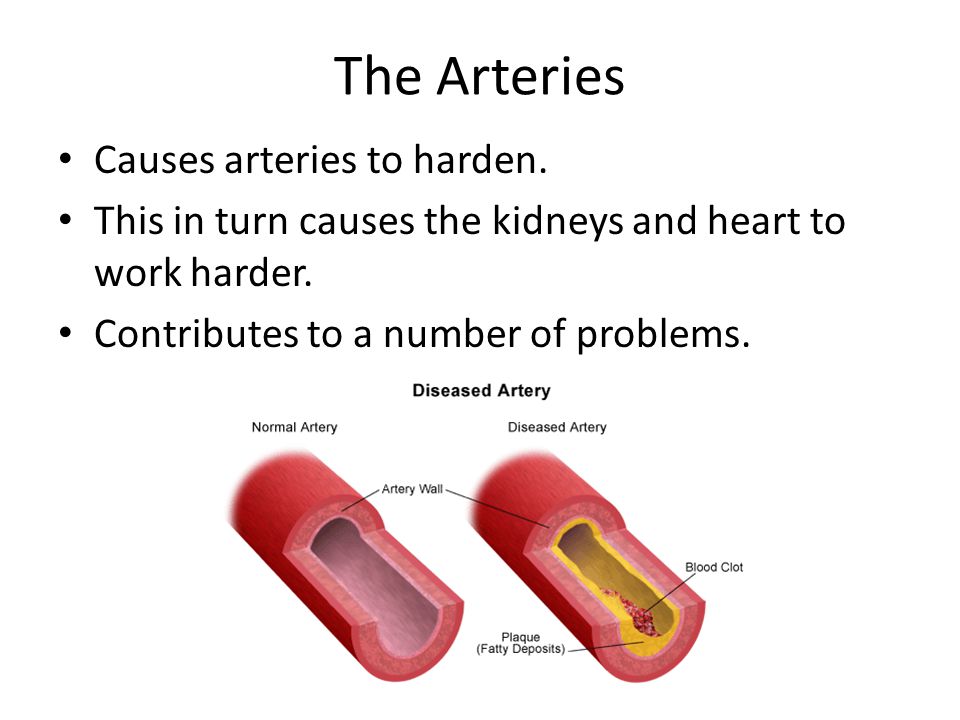 The Arteries Causes arteries to harden.