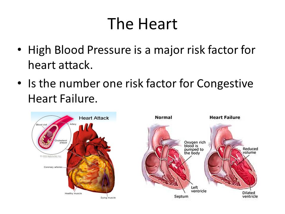 The Heart High Blood Pressure is a major risk factor for heart attack.