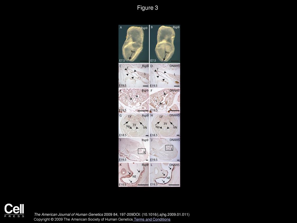 Figure 3 Expression of Rsph9 in the Node and Ciliated Epithelia