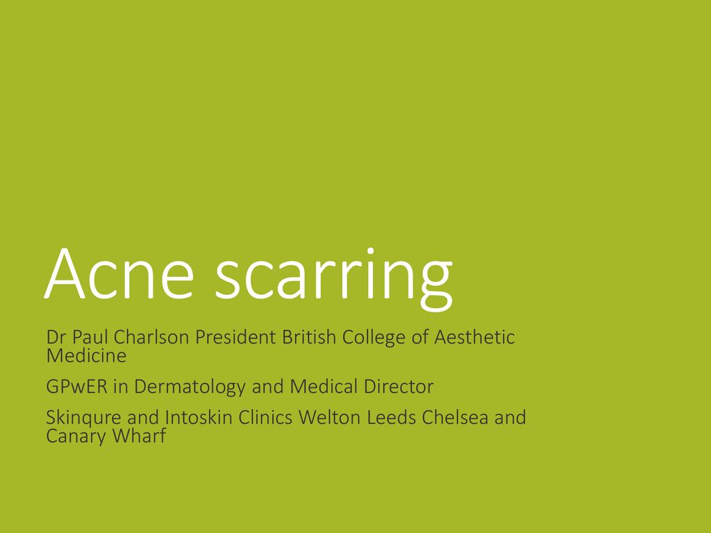 Acne scarring Dr Paul Charlson President British College of Aesthetic Medicine. GPwER in Dermatology and Medical Director.