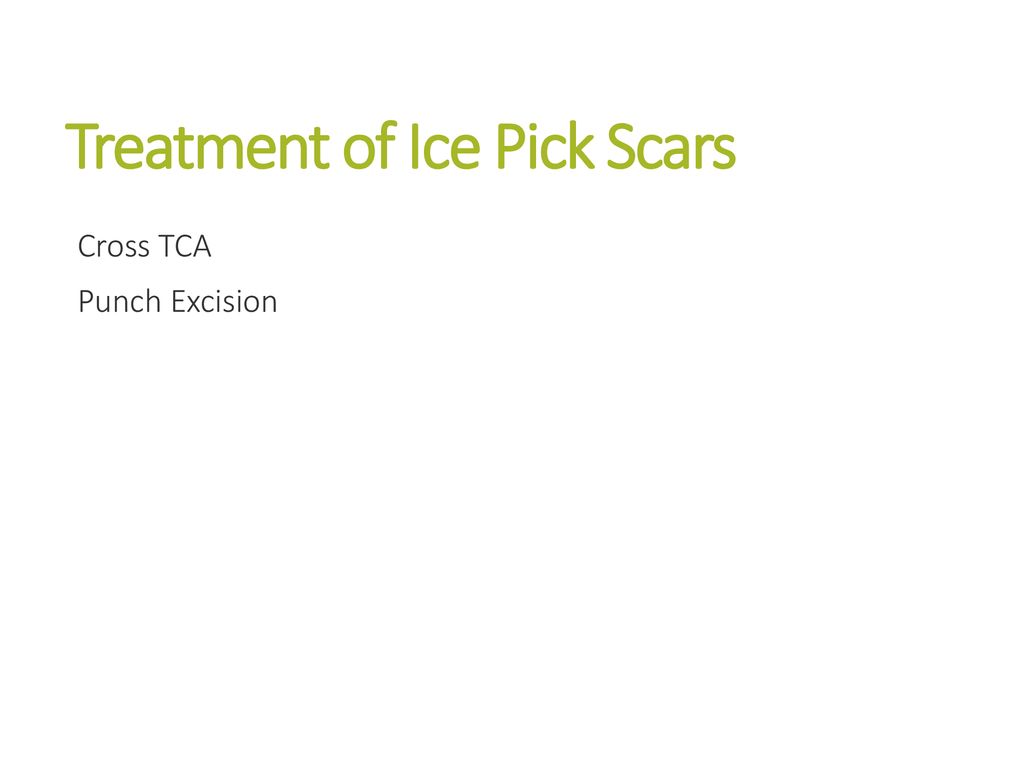 Treatment of Ice Pick Scars