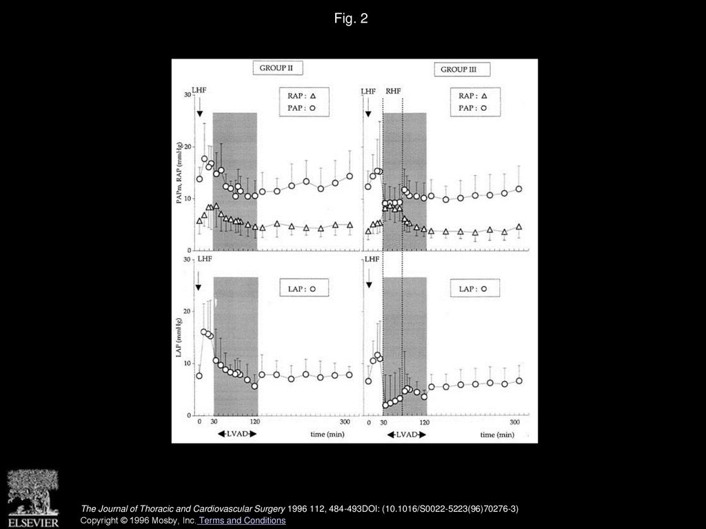 Effects of failure of the right side of the heart and increased ...