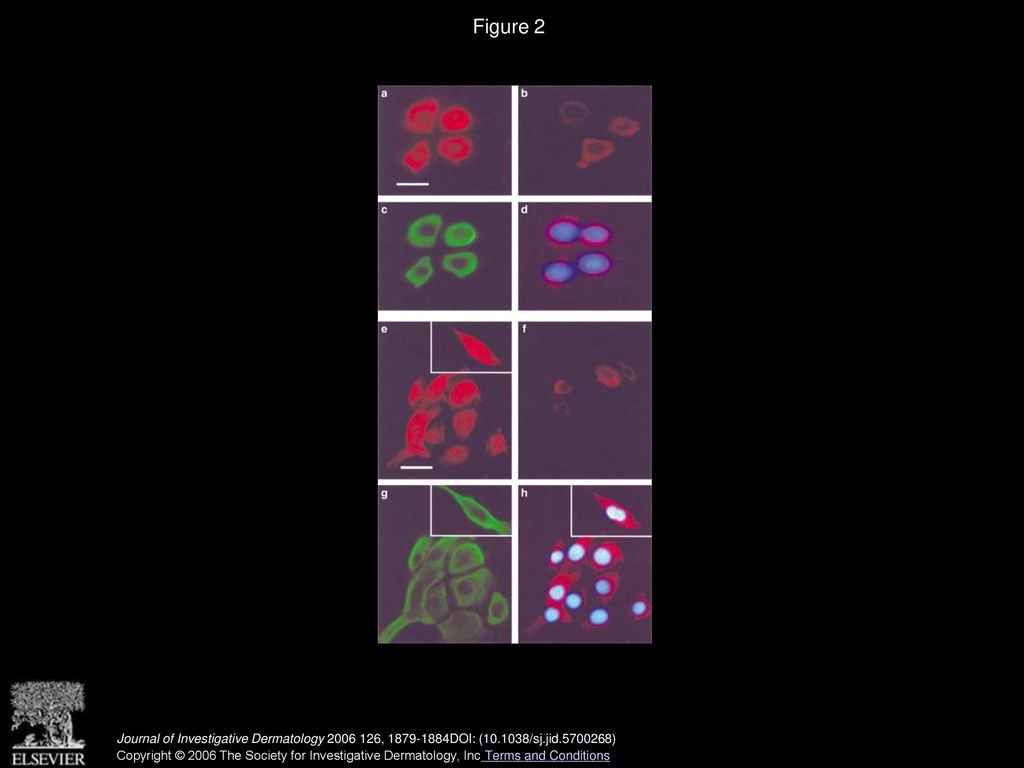 The vesicular acetylcholine transporter is present in melanocytes and