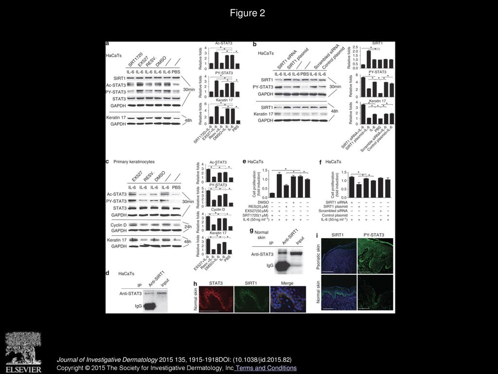 SIRT1 Activation Ameliorates Aldara-Induced Psoriasiform Phenotype and ...