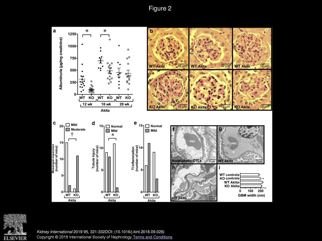 Podocyte Cn Activity Is Increased In Akita Mice Frozen Tissue Sections