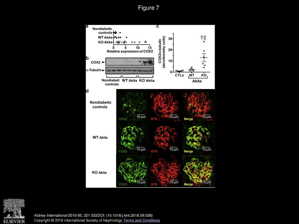 Podocyte Cn Activity Is Increased In Akita Mice Frozen Tissue Sections