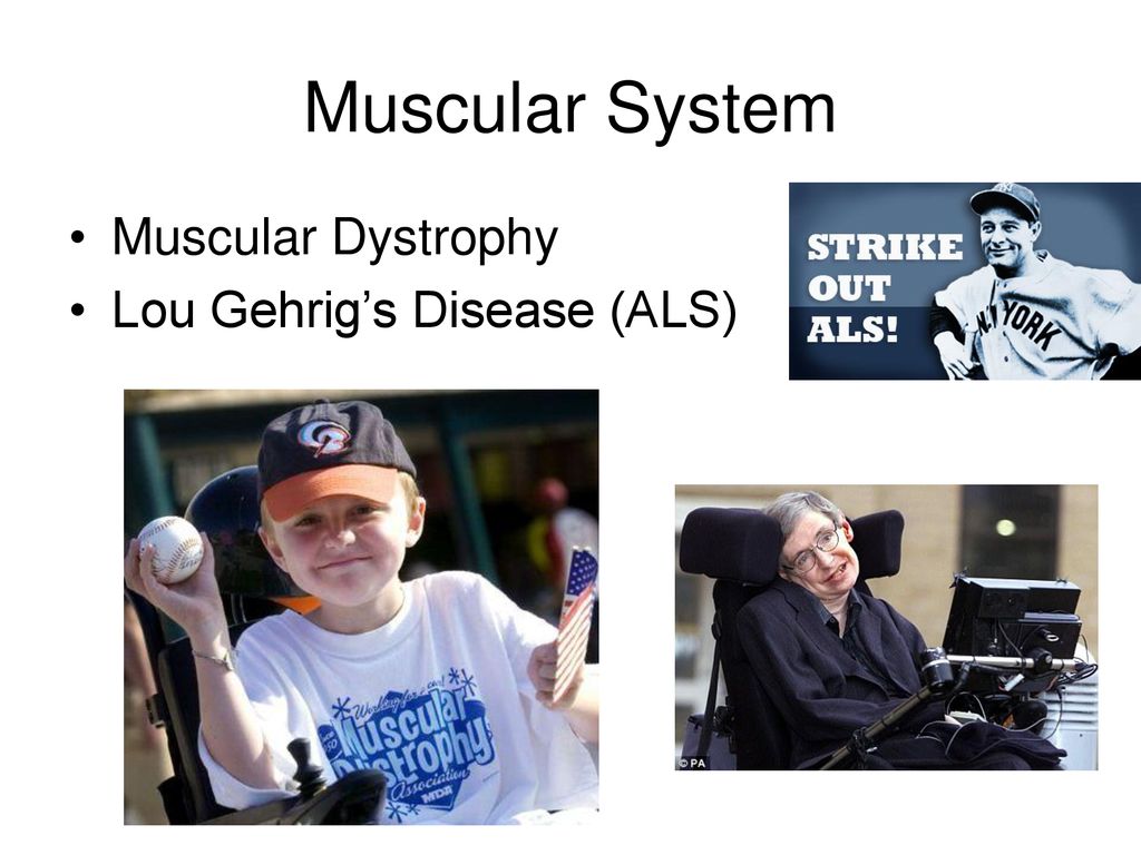 Muscular System Muscular Dystrophy Lou Gehrig’s Disease (ALS)