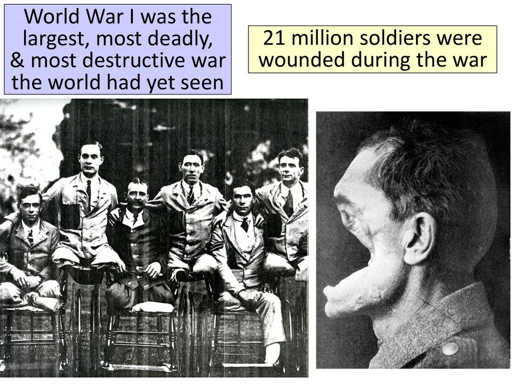 21 million soldiers were wounded during the war