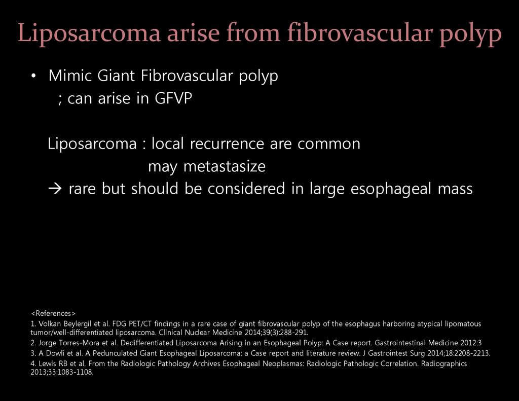 Dysphagia (8 months ago) - ppt download