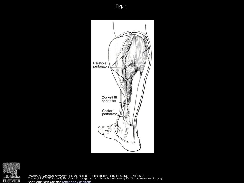 Geza Mozes, MD, Peter Gloviczki, MD, Sunil S. Menawat, MD, Dean R - ppt ...