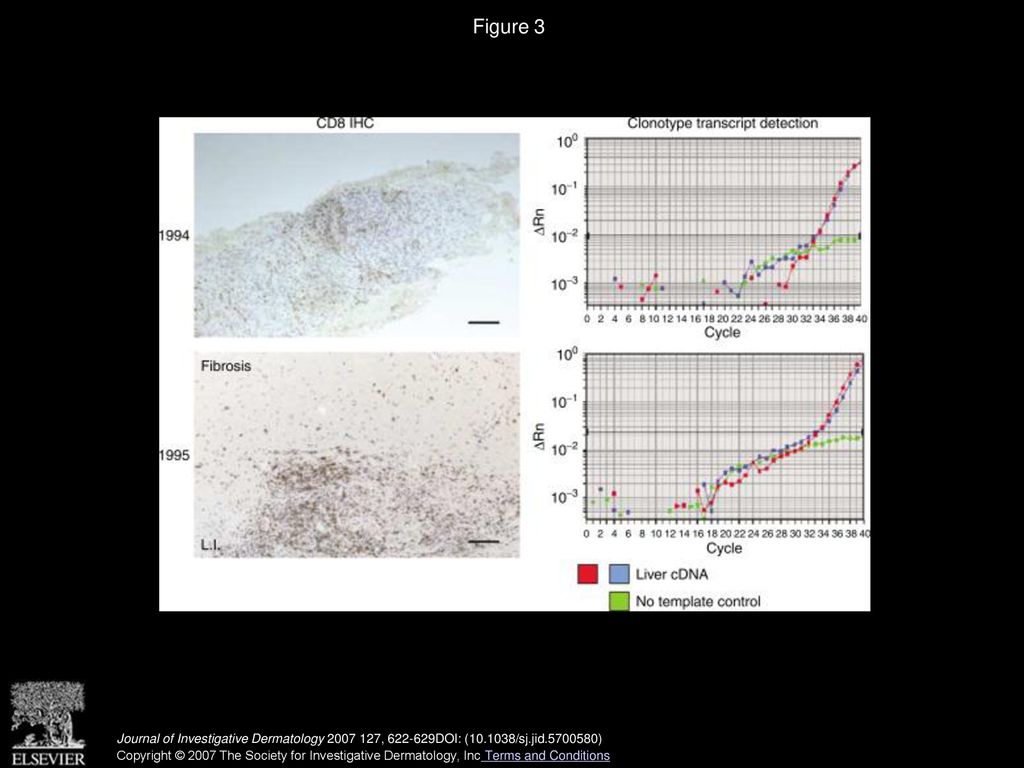 Tissue Homing And Persistence Of Defined Antigen Specific Cd8 Tumor