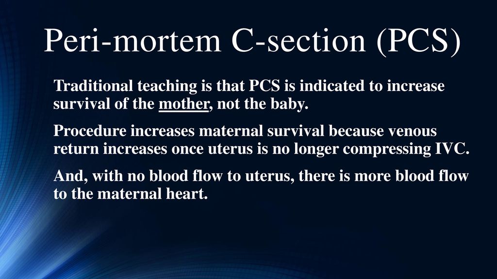 Peri-Mortem Cesarean Section - ppt download