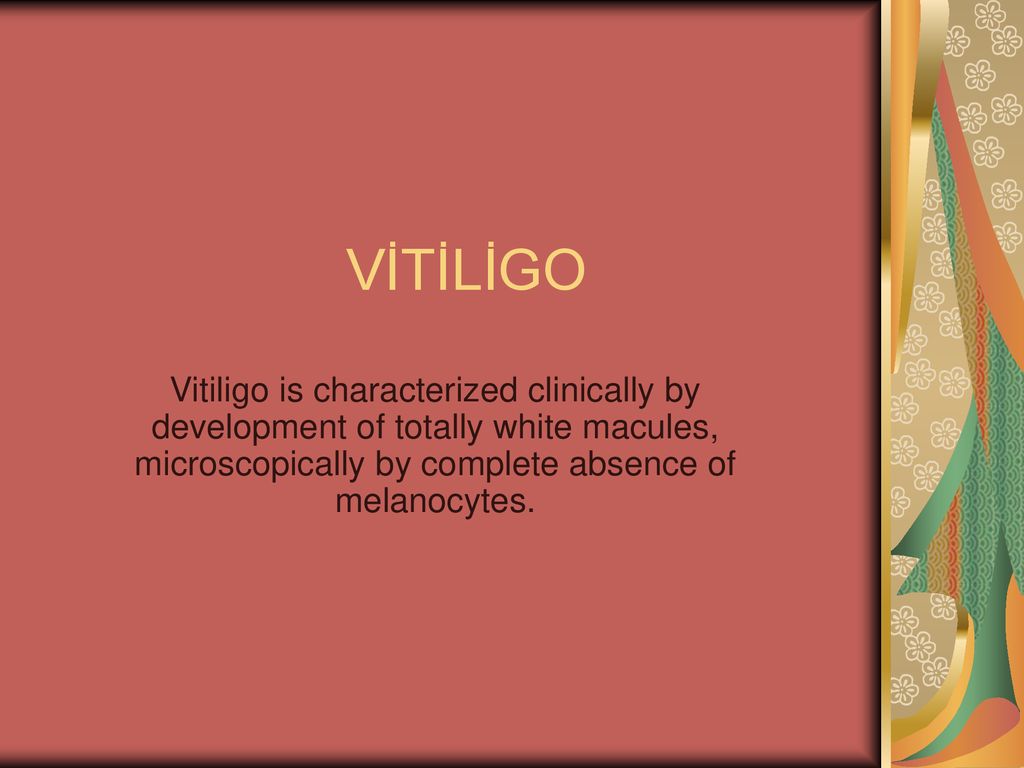 VİTİLİGO Vitiligo is characterized clinically by development of totally white macules, microscopically by complete absence of melanocytes.