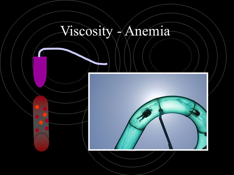 Viscosity - Anemia