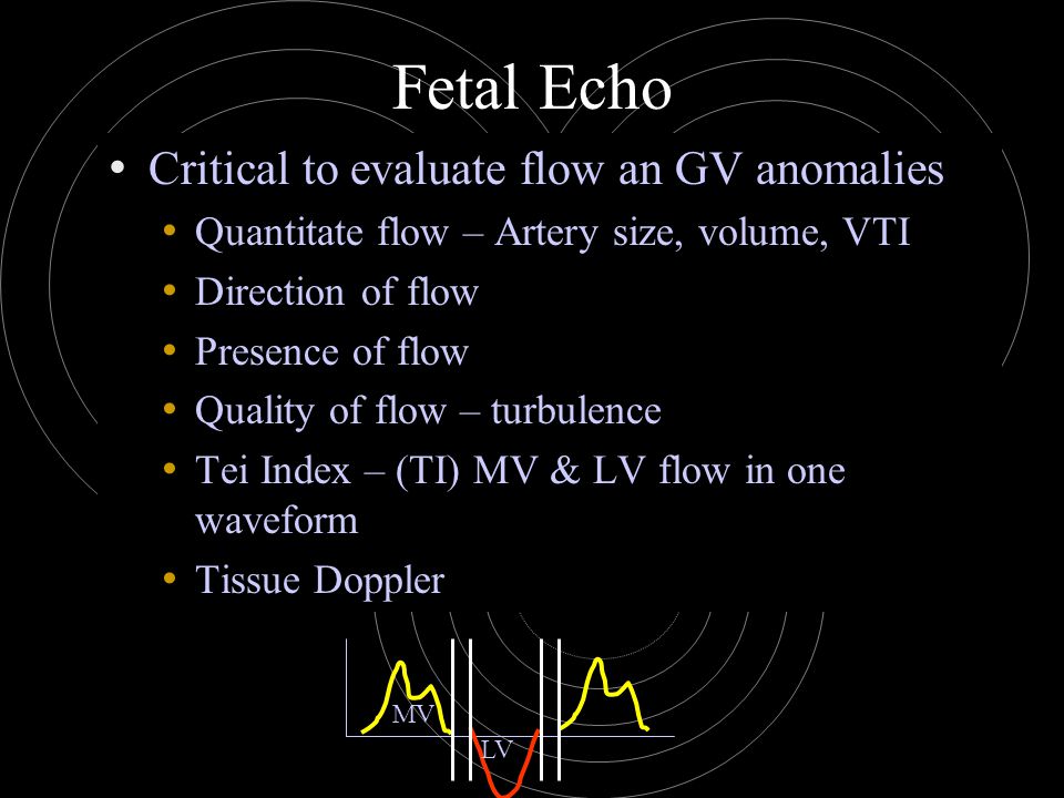 Fetal Echo Critical to evaluate flow an GV anomalies