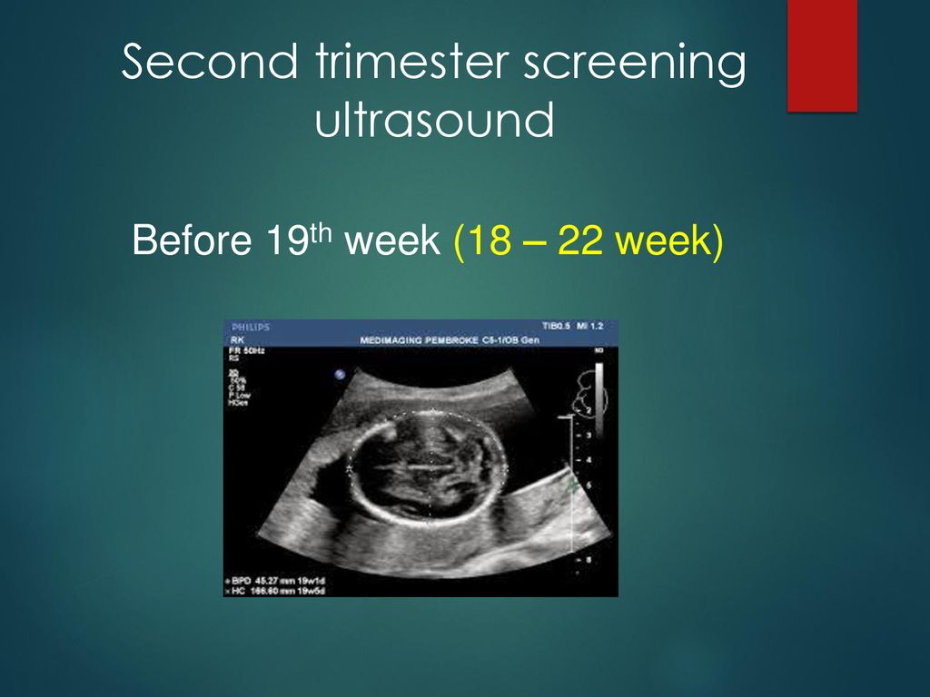 Trimester ultrasound second Cervical incompetence
