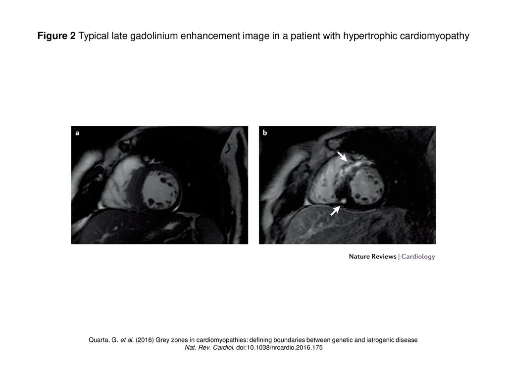 Nat rev cardiol doi nrcardio ppt download