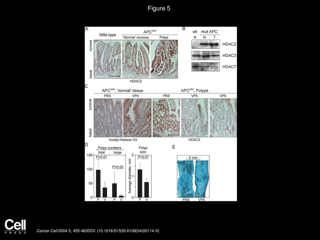 Figure 5 Intestinal HDAC2 expression and adenoma development in VPA-treated APCmin mice.