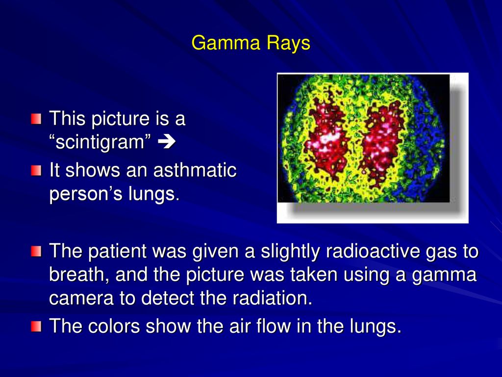 Gamma Rays This picture is a scintigram  It shows an asthmatic person’s lungs.