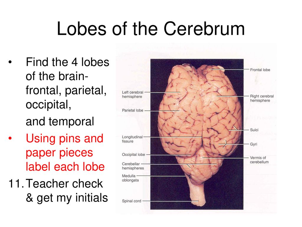 Sheep Brain Dissection Guide - ppt download