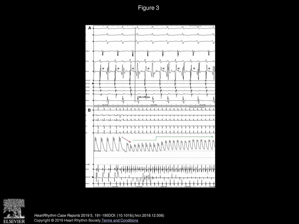 Elisa Ebrille MD Fernando M Contreras Valdes MD Peter J Ppt Download volume-83-issue-5-pages-may-2013-ppt-download